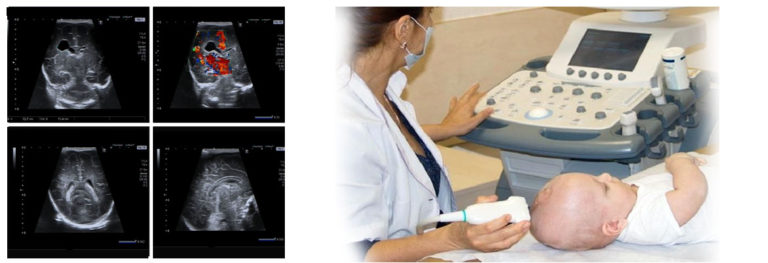 Neuro-Imaging (Brain Sonography) - Radiology Center Nagpur